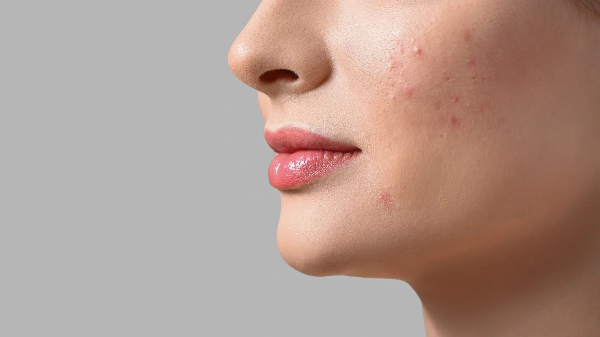 PEAU ET INFLAMMATION : COMMENT AGIR DE L'INTÉRIEUR