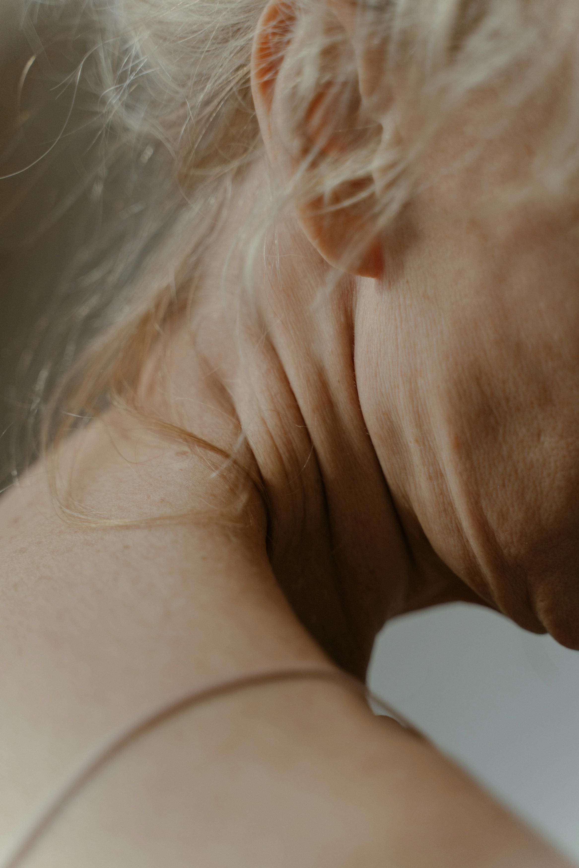 QUEL EST LE PLUS PUISSANT ANTI-RIDES NATUREL ?