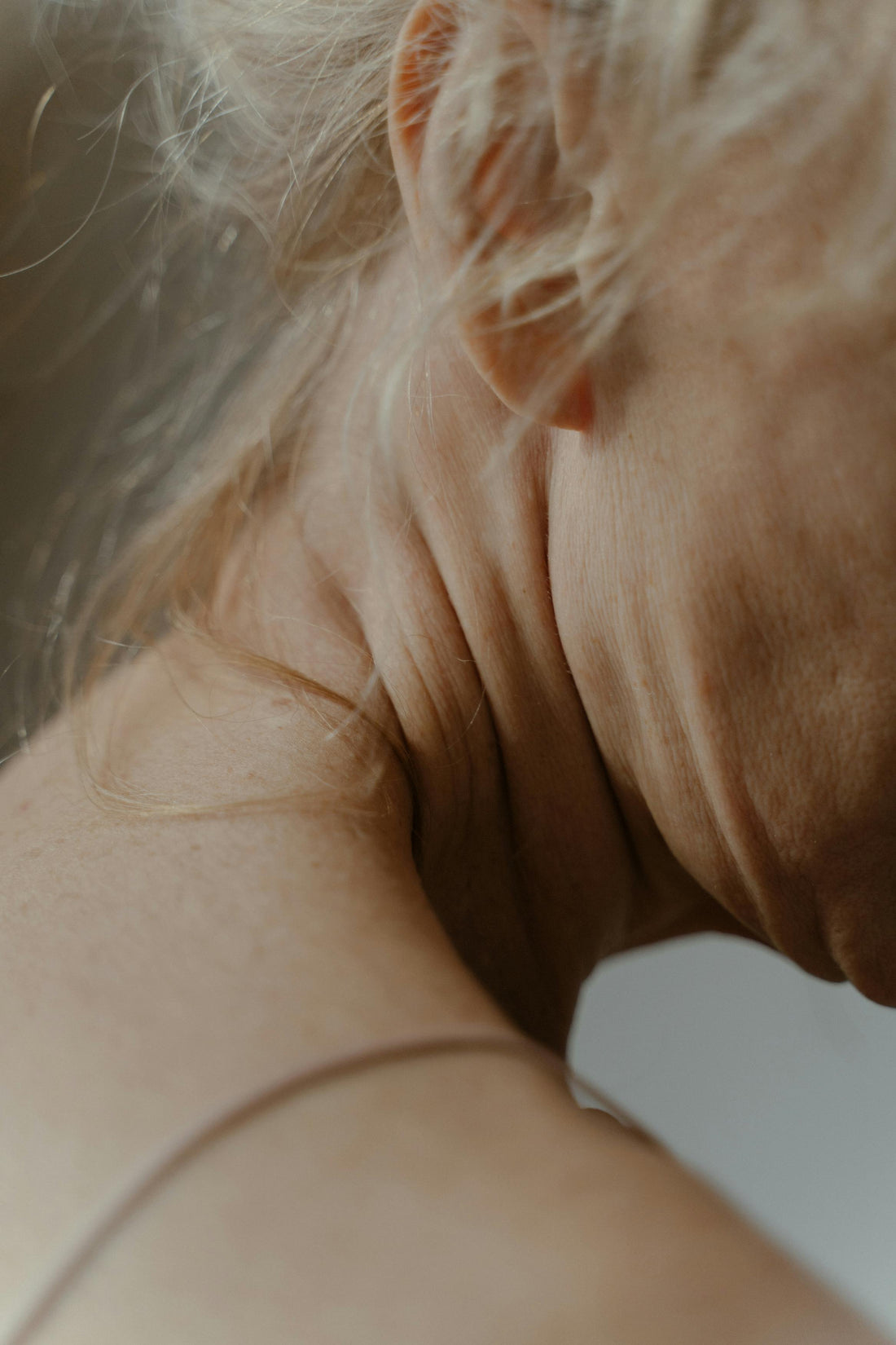 RIDULES : CAUSES, PRÉVENTION ET SOLUTIONS NATURELLES